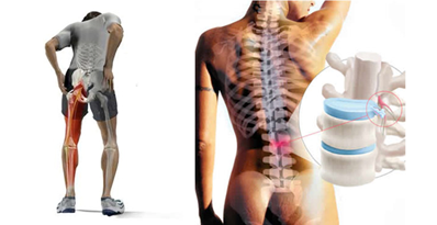 ejercicios para el dolor lumbar Natural